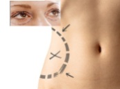 Liposuction and Eyelid Surgery as Cosmetic Surgery Claims and Compensation