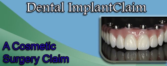 Dental Implant Claim: A Cosmetic Surgery Claim